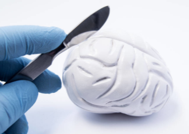 大脑传感器：高分辨率脑信号记录 提高切除脑肿瘤能力